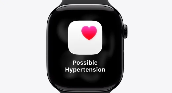 Apple watch series 11