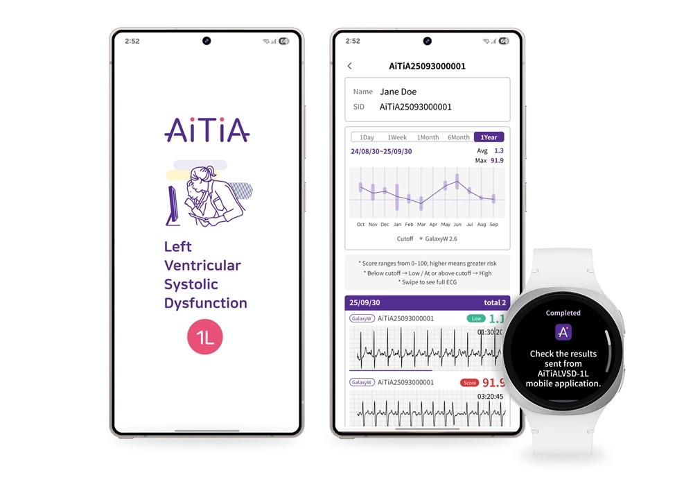 nova funcionalidade da samsung para galaxy watch